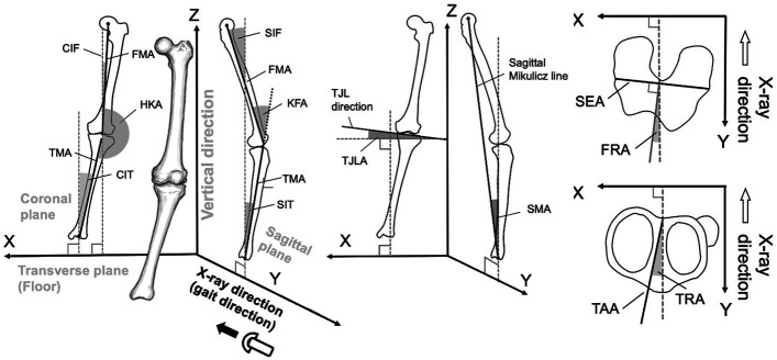 Three-Dimensional Lower Extremity Alignment During the Stance Phase of Gait Using Anteroposterior Fluoroscopic Imaging and Image-Matching Technique: A Comparison with the Standing Position in Advanced Knee Osteoarthritis.