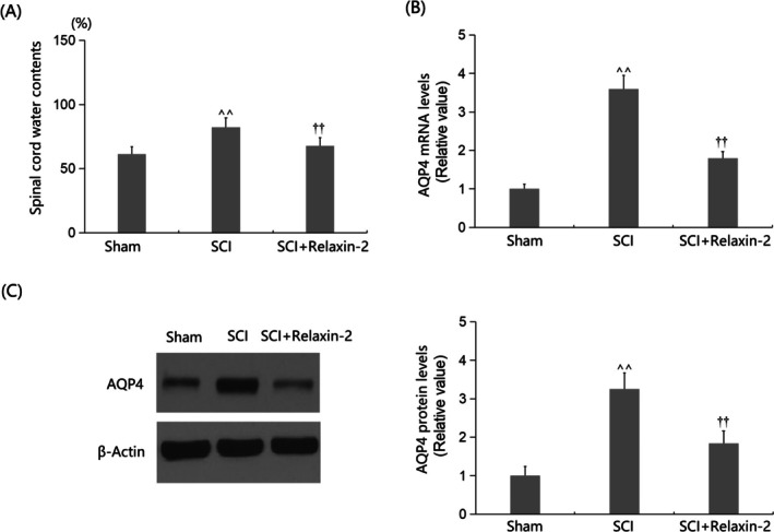 Relaxin-2 Ameliorates Spinal Cord Injury by Inhibiting Microglia Activation.