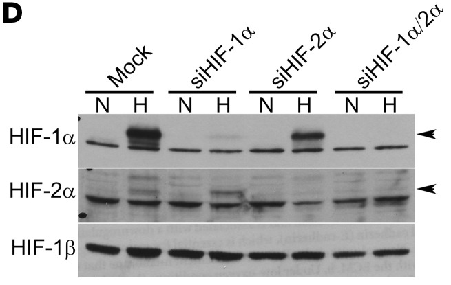 Corrigendum to Suppression of dual-specificity phosphatase-2 by hypoxia increases chemoresistance and malignancy in human cancer cells.