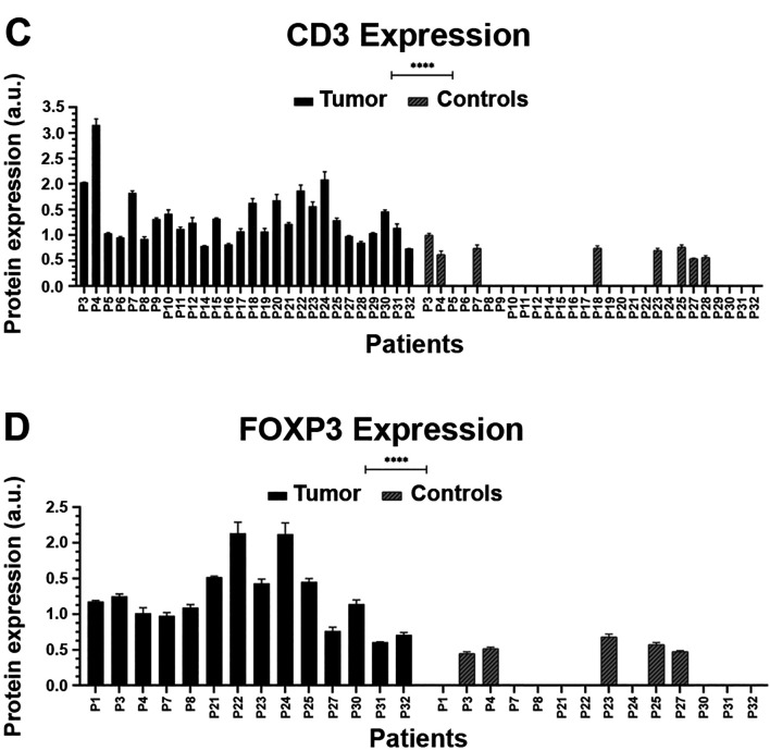 Quantitative Analysis of CD27/CD70 Protein Expression and Investigation of Related Mechanisms in the Tumor Microenvironment of NSCLC.
