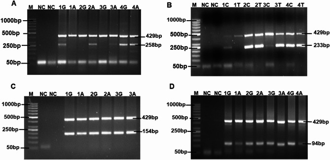 IL10 (-1082 G>A, rs1800896) gene polymorphisms are associated with oxidative stress in sickle cell disease patients in Uganda.