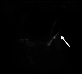 Rare Case of Systemic Cryptococcal Lymphadenopathy in a Persian Cat.