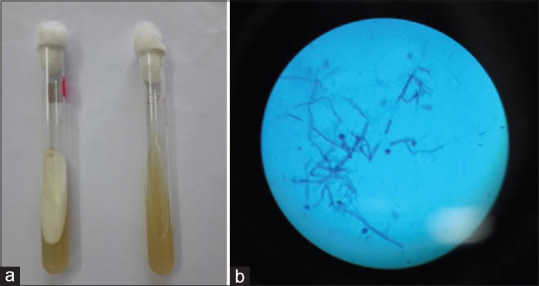 Trichophyton Mentagrophytes : An Emerging Cause of Tinea Capitis in Rural Part of North Karnataka.