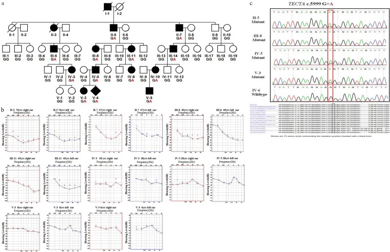 A novel splicing variant in TECTA associated with prelingual autosomal dominant nonsyndromic hearing loss via dominant-negative effect.