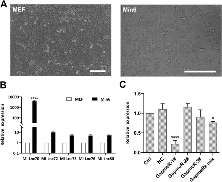 Mi-Lnc70 Regulates the Progression of Murine Pancreatic β-Cell Line and Affects the Synthesis of Insulin and Glucagon.