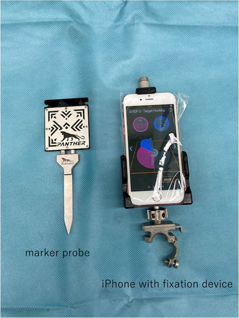 Accuracy of cup positioning of a non-invasive augmented reality-based navigation system for total hip arthroplasty in the supine position.
