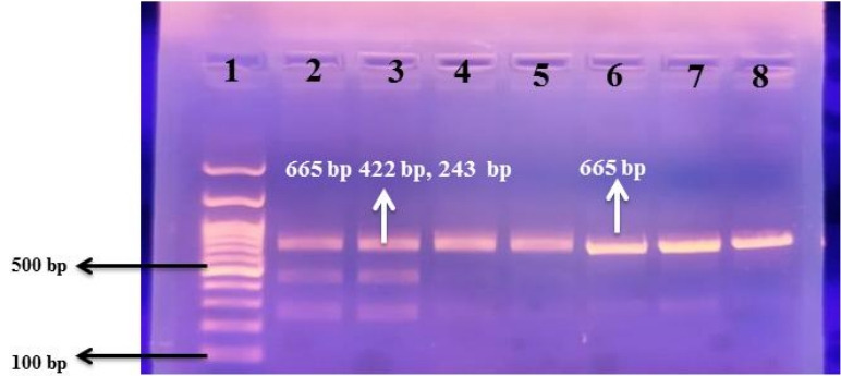 Association of macrophage migration-inhibitory factor gene and growth differentiation factor 15 gene polymorphisms and their circulating levels with respiratory distress syndrome among preterm neonates.