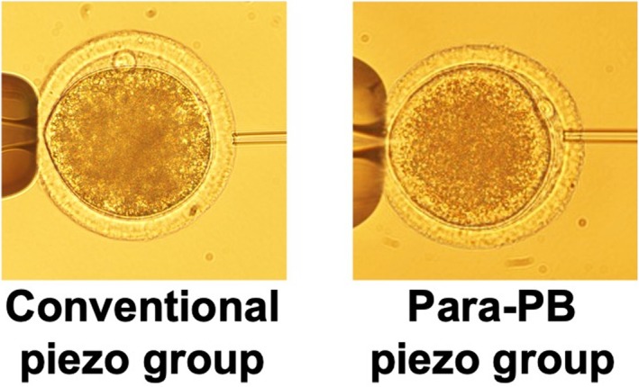 Sperm Injection at the Para-Polar Body Site in Piezo-Intracytoplasmic Sperm Injection Improves Subsequent Early Development of Bovine Embryos.