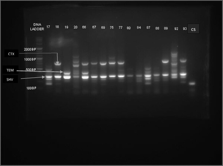 Antibiotic resistance pattern of multidrug-resistant Enterobacterales from a rectal surveillance study in northern Nigeria.