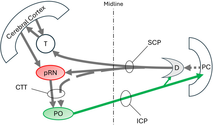 Multifaceted Mesodiencephalic Triangles: Insights into Hypertrophic Olivary Degeneration and Oculopalatal Tremor Pathophysiology.