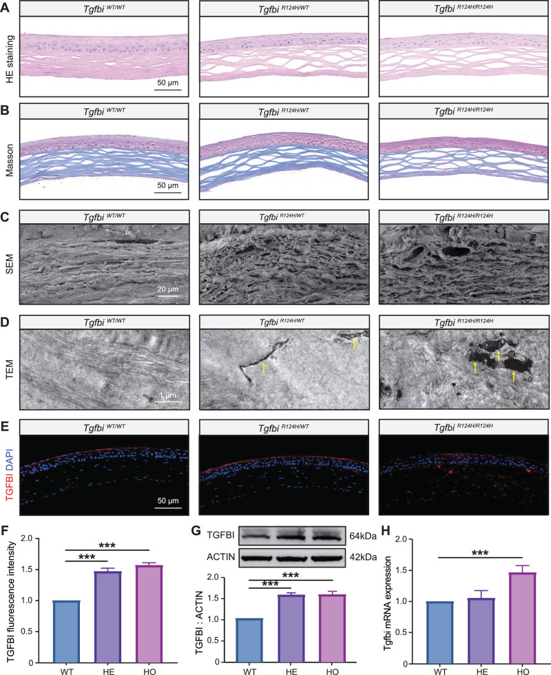 A Novel Mouse Model of Granular Corneal Dystrophy Type II Reveals Impaired Autophagy and Recapitulates Human Pathogenesis.