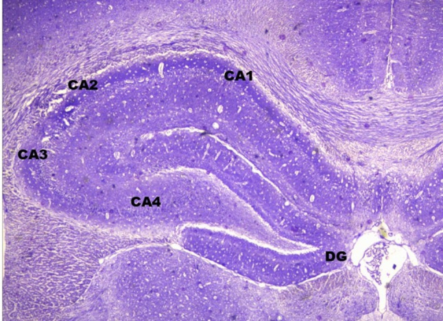 Implicating neuroinflammation in hippocampus, prefrontal cortex and amygdala with cognitive deficit: a narrative review.