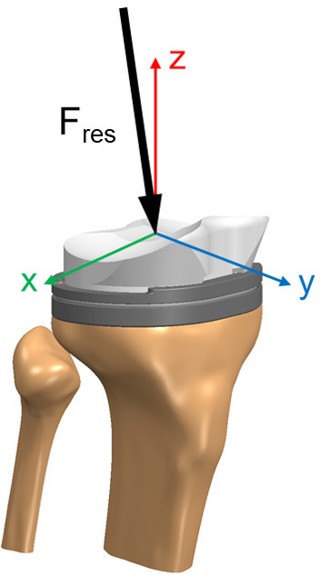 Loading of the artificial knee during early rehabilitation and physiotherapy : an in vivo study.