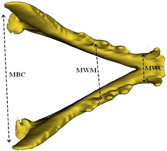 Craniometric and Topographic Analysis of British Shorthair and Scottish Fold Cats Using Three-Dimensional Modelling.