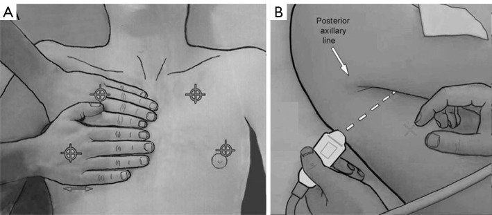 Prediction of weaning outcomes from mechanical ventilation in critically ill patients based on the combination of ultrasound parameters of the heart, lung, and diaphragm: a prospective observational cohort study.