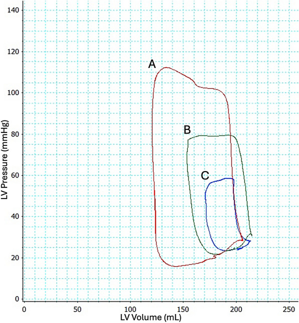 Comparison of changes in arterial blood pressure and cardiac output during cardiogenic shock development in a porcine model.