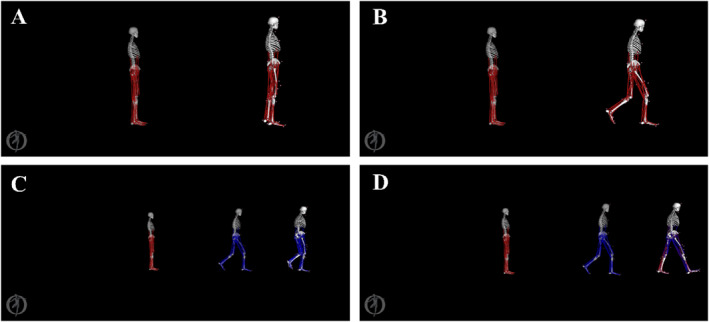 Muscle Synergies of the Lower Extremities During Gait Initiation in Individuals With and Without Chronic Ankle Instability.