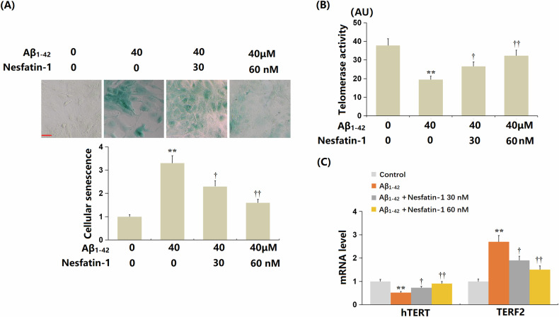 Nesfatin-1 ameliorates blood-brain barrier dysfunction in Alzheimer's disease by targeting VEGF-R1 and reducing cellular senescence in brain vascular endothelial cells.