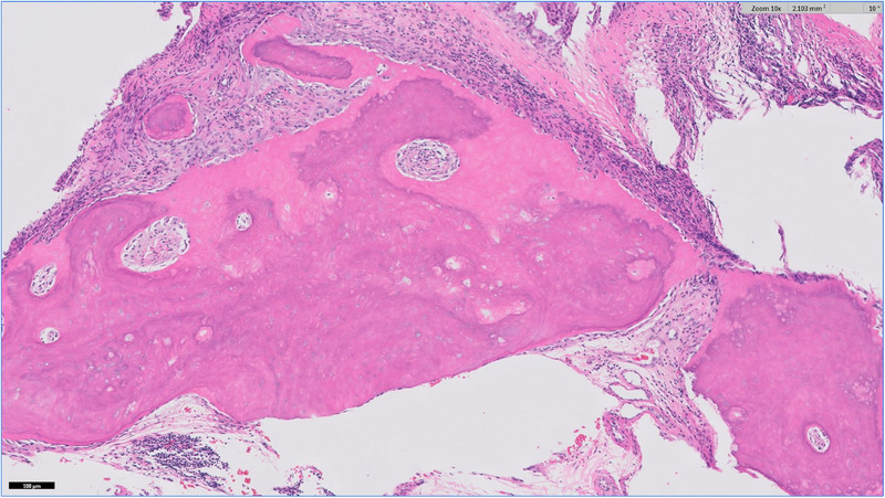 Diffuse Osteosclerosis in a Young Cat Presenting With Chronic Nasal Congestion: A Case Report.