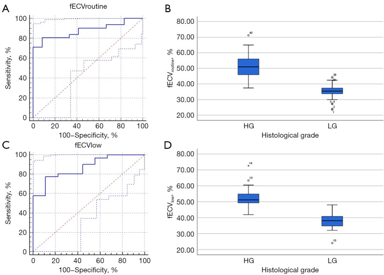 Extracellular volume fraction based on dual-layer spectral computed tomography in assessment of gastric cancer: feasibility analysis of low-dose equilibrium phase scanning.