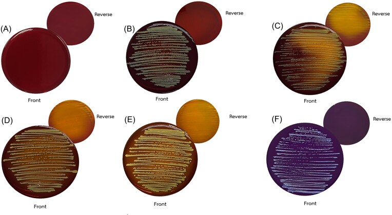 Closing the diagnostic gap in medical mycology: The LODDY Test for identification of Lodderomyces elongisporus.