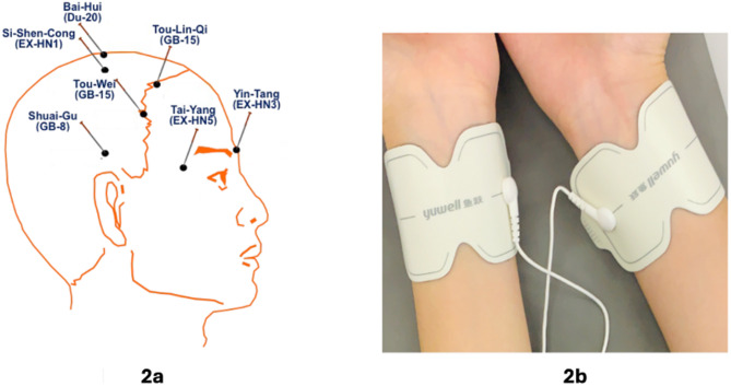Electrical acupoint stimulation for psychiatric sequelae in women victims of domestic violence: study protocol for an assessor-blind randomized controlled trial.