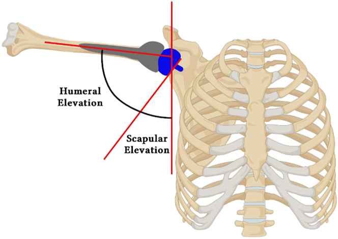 The scapulothoracic conundrum in reverse shoulder arthroplasty: where do we stand and what is yet to expand?