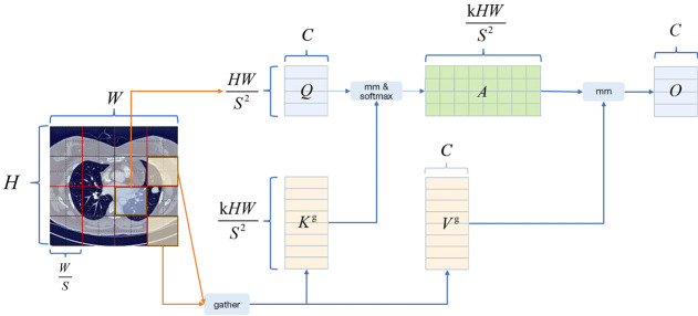 YOLOv8-BCD: a real-time deep learning framework for pulmonary nodule detection in computed tomography imaging.