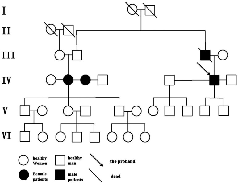 Epistaxis due to hereditary hemorrhagic telangiectasia: A case report and literature review.