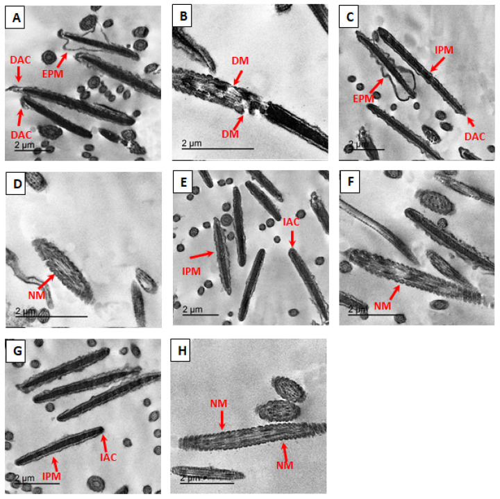 The beneficial impact of pomegranate oil nanoemulsion on the quality of cryopreserved bovine sperm: antioxidant and anti-apoptotic effects.