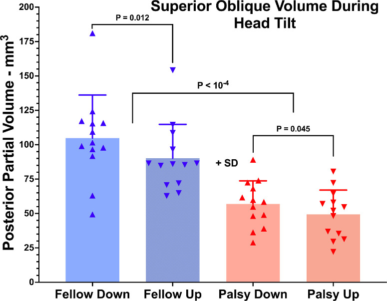 Functional Anatomy of Ocular Counter-Rolling in Superior Oblique Palsy.