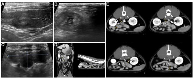 GS-441524 Treatment in a Cat With Feline Infectious Peritonitis Virus and Pyogranulomatous Transverse Colon Lesion.