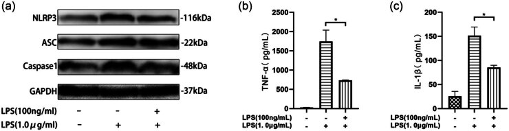 Endotoxin tolerance inhibits NLRP3 inflammasome activation in macrophages of septic mice by restoring autophagic flux through TRIM26.