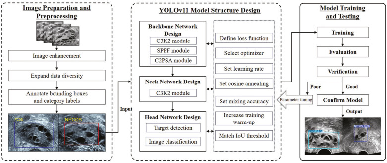 A Deep Learning-Based Automatic Recognition Model for Polycystic Ovary Ultrasound Images