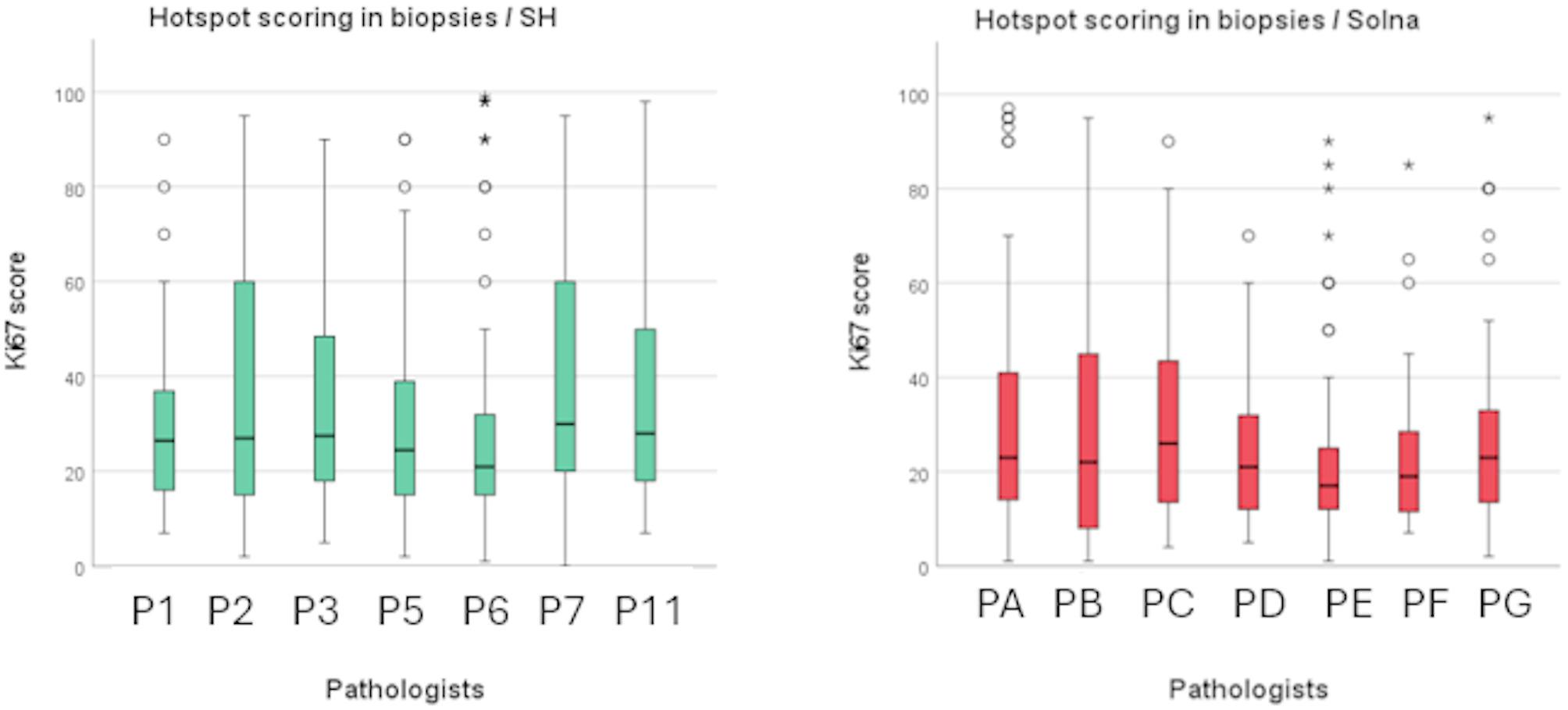 Global scoring method of Ki67 immunohistochemistry in breast cancer demonstrates improved concordance using real-world multi-institutional data.