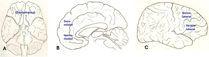 Implicating neuroinflammation in hippocampus, prefrontal cortex and amygdala with cognitive deficit: a narrative review.