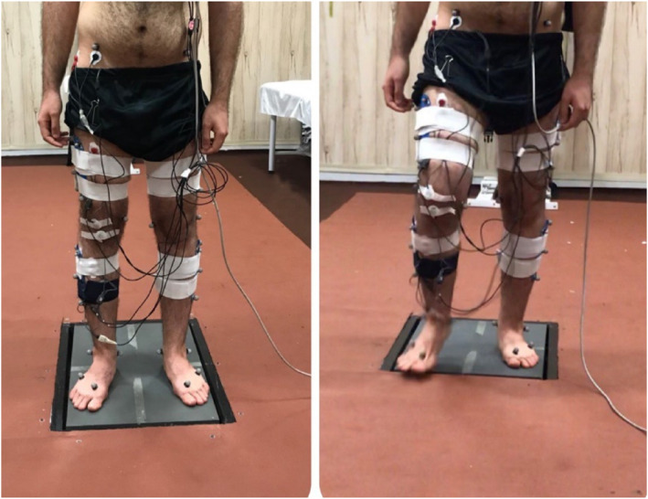 Muscle Synergies of the Lower Extremities During Gait Initiation in Individuals With and Without Chronic Ankle Instability.