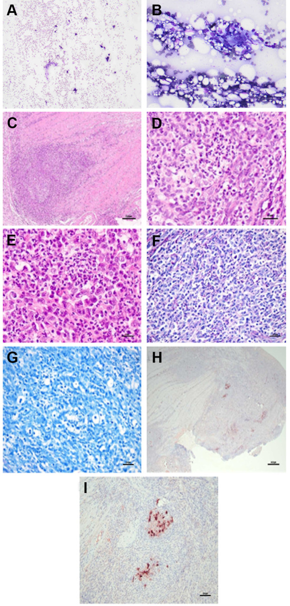 GS-441524 Treatment in a Cat With Feline Infectious Peritonitis Virus and Pyogranulomatous Transverse Colon Lesion.