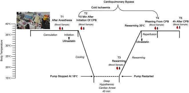 Effects of Ulinastatin on Inflammation Response and Lung Tissue Injury in Deep Hypothermic Circulatory Arrest.