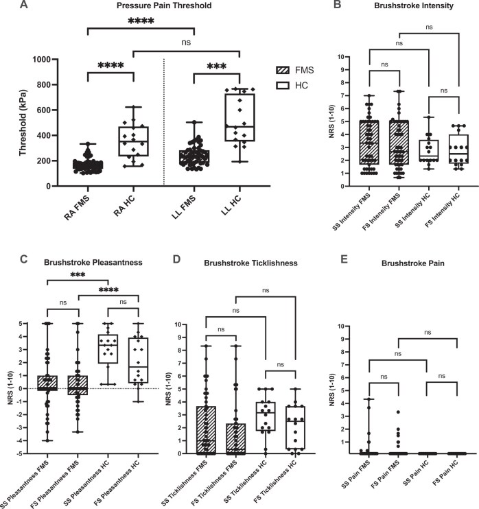 Aftersensations and Lingering Pain After Examination in Patients with Fibromyalgia Syndrome.