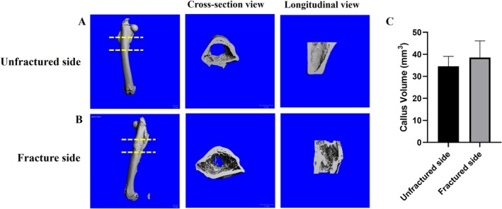 Establishment of Subtrochanteric Fracture in Pre-Clinical Animal Model.