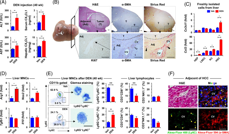 CX3CR1+ macrophages interact with HSCs to promote HCC through CD8+ T-cell suppression.