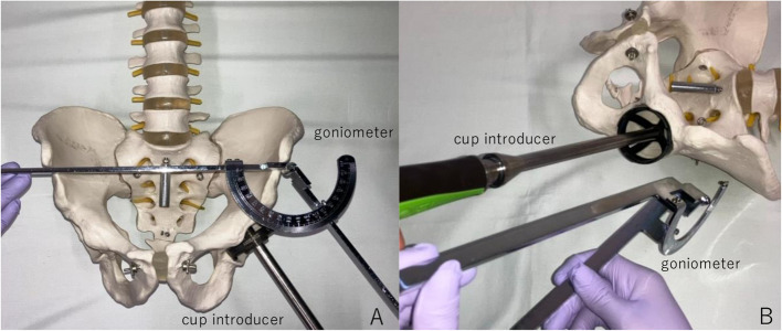 Accuracy of cup positioning of a non-invasive augmented reality-based navigation system for total hip arthroplasty in the supine position.
