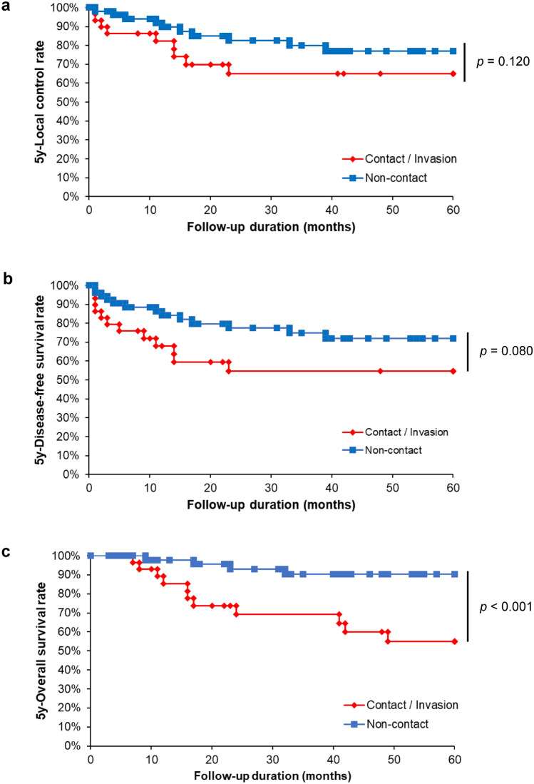 Pterygomandibular raphe invasion as a novel grading and prognostic factor for squamous cell carcinoma of buccal mucosa: a retrospective study with propensity score matching.