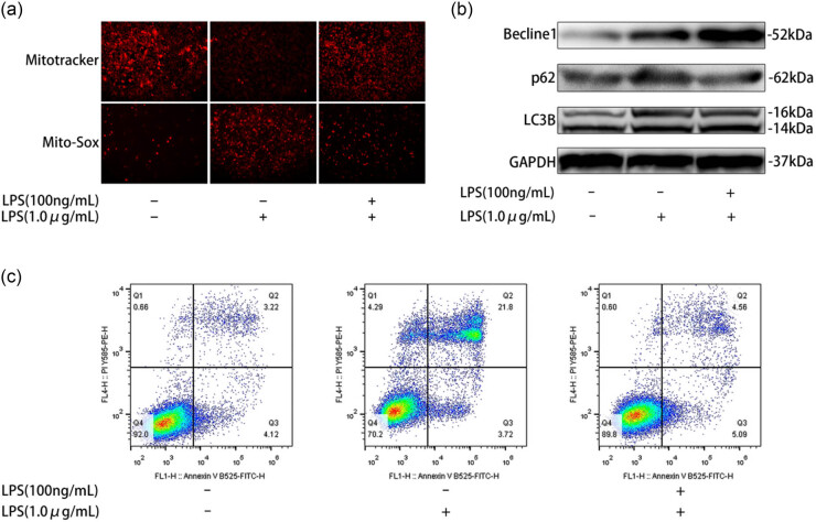 Endotoxin tolerance inhibits NLRP3 inflammasome activation in macrophages of septic mice by restoring autophagic flux through TRIM26.