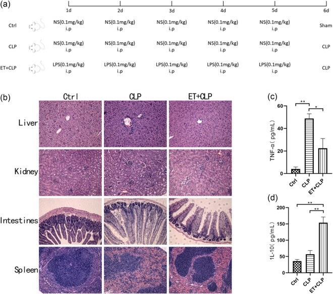 Endotoxin tolerance inhibits NLRP3 inflammasome activation in macrophages of septic mice by restoring autophagic flux through TRIM26.