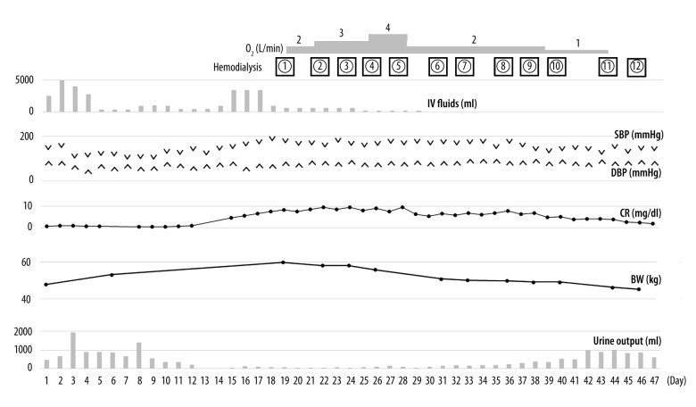 Staphylococcus-Induced Glomerulonephritis Following Burn Injury: A Case Report.
