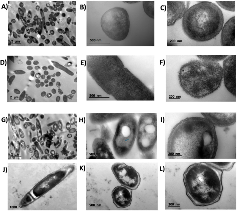 Identification of novel Gramicidin S analogs from Aneurinibacillus aneurinilyticus isolated from corn steep liquor with potential antifungal activity.