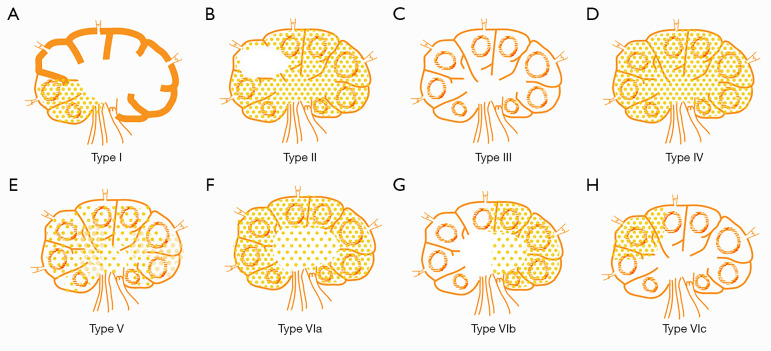 The value of percutaneous contrast-enhanced ultrasound in the detection and diagnosis of sentinel lymph nodes in breast cancer: comparison with pathological features.