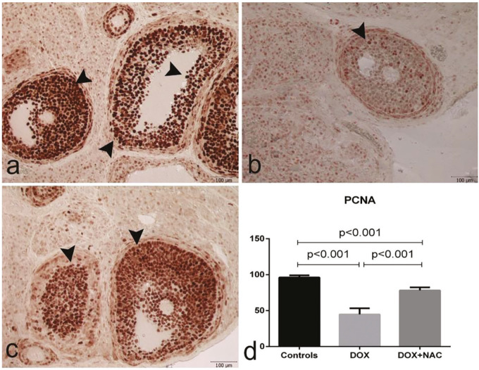 Protective effect of N-acetylcysteine in doxorubicin-induced primary ovarian failure in female rats.
